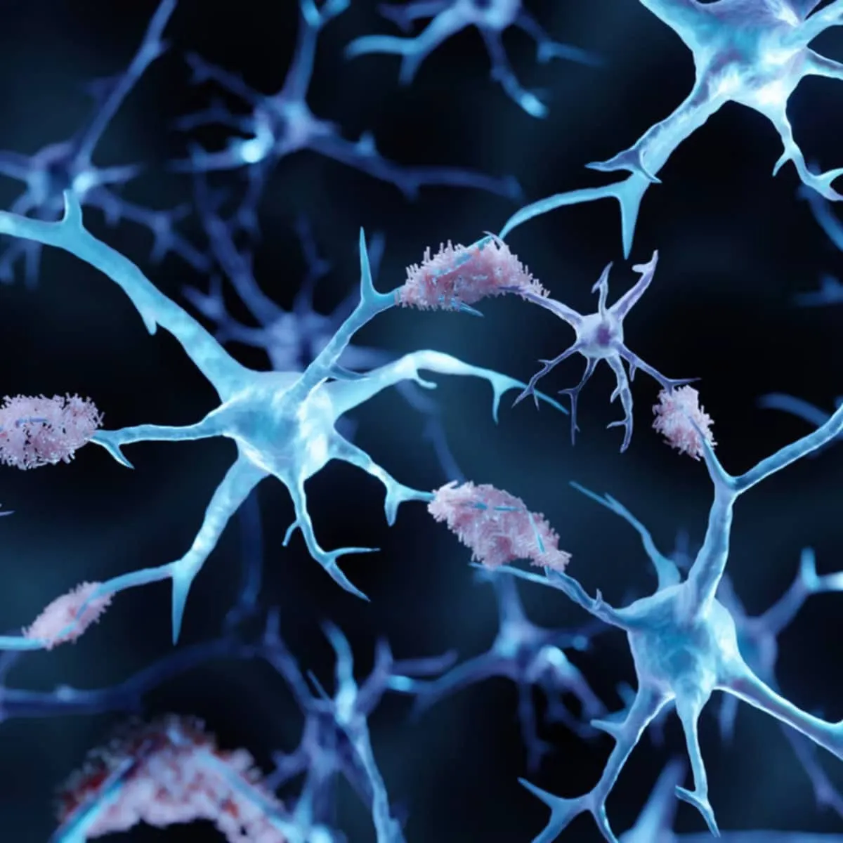 Kan djupsömn skydda mot Alzheimers?